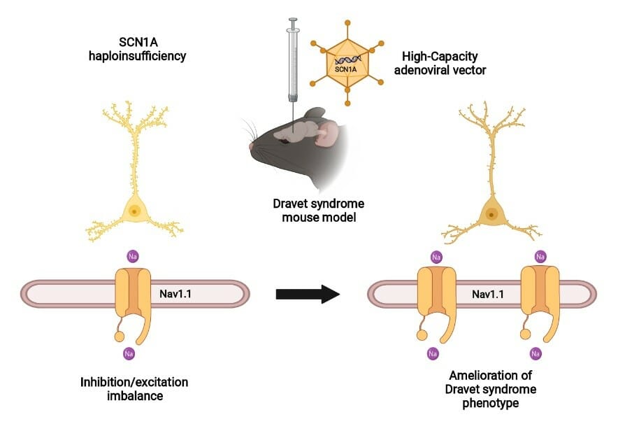 Transfer of SCN1A to the brain of adolescent mouse model of Dravet syndrome